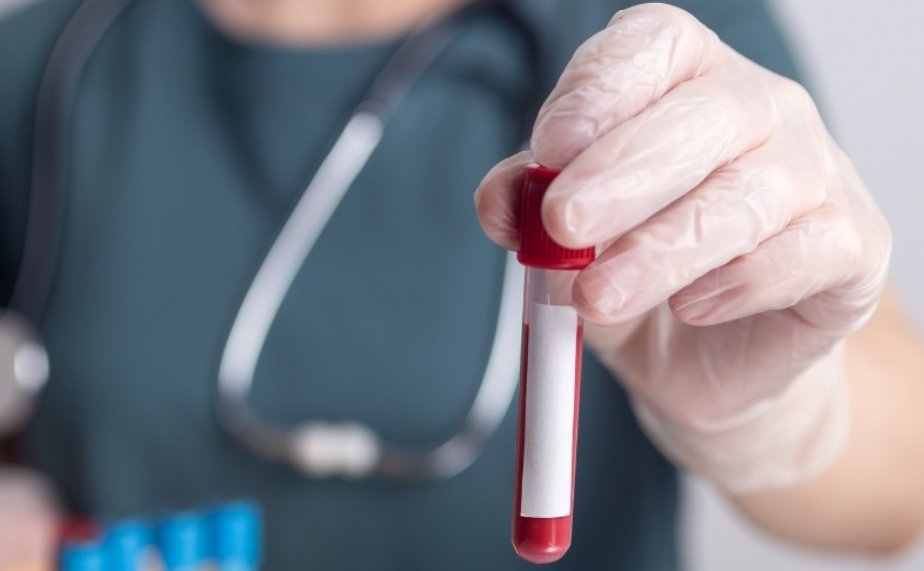 R-Bridge announces $40 M financing for Singapore-based diagnostic startup Mirxes to advance global expansion