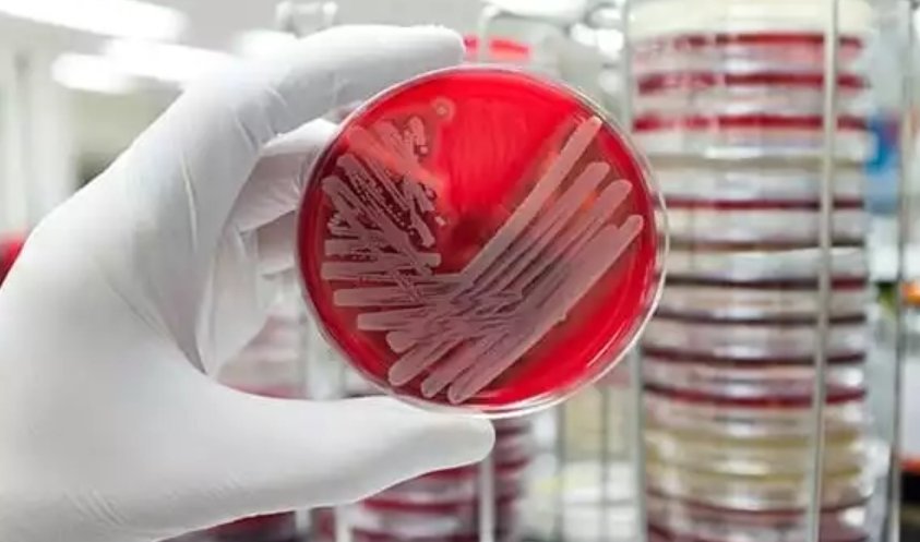 CrisprBits develops PathCrisp for early detection of antibiotic resistance