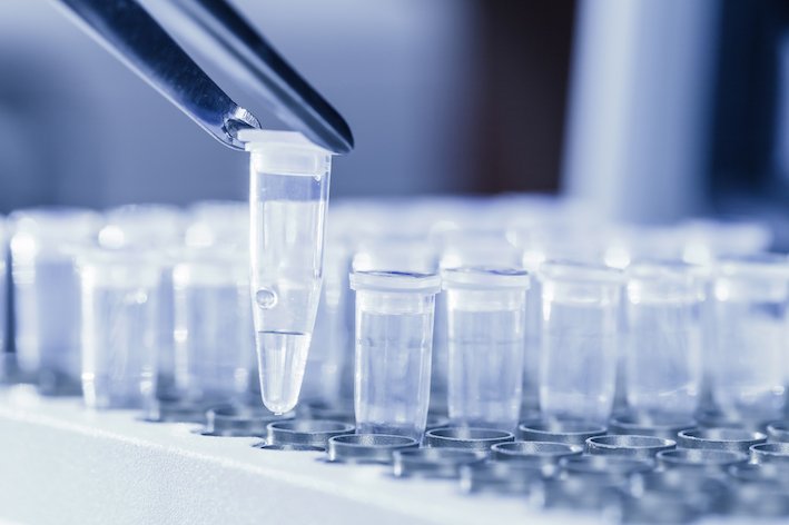 NeoDx Biotech Labs unveils 7 real time PCR based kits for detecting infectious diseases